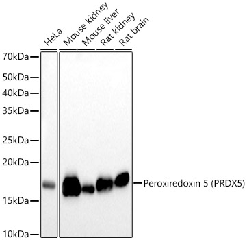 Peroxiredoxin 5 (PRDX5) Monoclonal Antibody [2N7H10]
