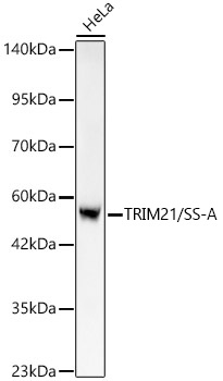 TRIM21/SS-A Monoclonal Antibody [7X9I8]