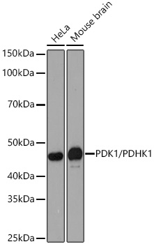 PDK1/PDHK1 Monoclonal Antibody [9A7X4]