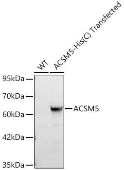 ACSM5 Polyclonal Antibody&nbsp;<img src="images/icon_newarrival.gif" alt="new" border="0">
