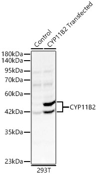 CYP11B2 Polyclonal Antibody