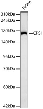CPS1 Monoclonal Antibody [1V7X8]