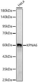 KPNA6 Monoclonal Antibody [8X5P6]