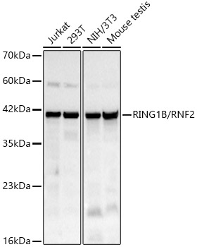 RING1B/RNF2 Monoclonal Antibody [3N6Z9]