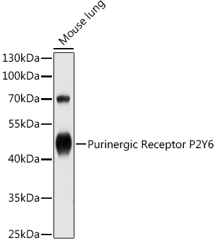 Purinergic Receptor P2Y6 Polyclonal Antibody