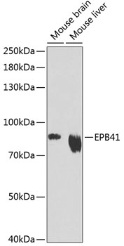 EPB41 Polyclonal Antibody