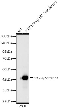 SSCA1/SerpinB3 Monoclonal Antibody [9R9K10]
