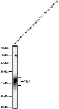 TSLP Monoclonal Antibody [9S5L1]