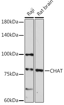 CHAT Polyclonal Antibody