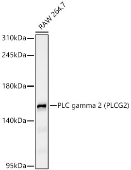 PLC gamma 2 (PLCG2) Monoclonal Antibody [0M1U7]