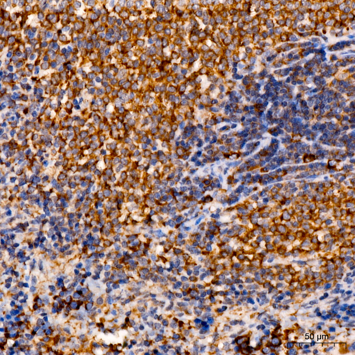 C1R Polyclonal Antibody