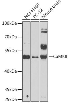 CaMKII Polyclonal Antibody