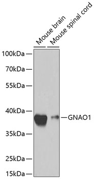 GNAO1 Polyclonal Antibody