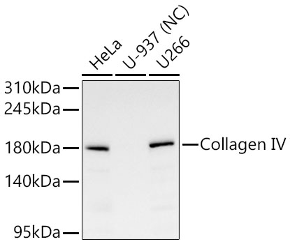 Collagen IV Monoclonal Antibody [1E7H5]