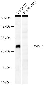 TWIST1 Monoclonal Antibody [8A8K6]