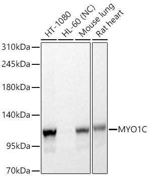 MYO1C Monoclonal Antibody [8V10Q4]