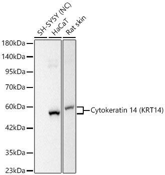 Cytokeratin 14 (KRT14) Monoclonal Antibody [2W8X6]