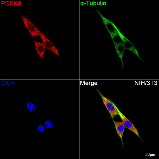 PCSK9 Monoclonal Antibody [7F8M5]
