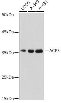 ACP5 Polyclonal Antibody&nbsp;<img src="images/icon_newarrival.gif" alt="new" border="0">