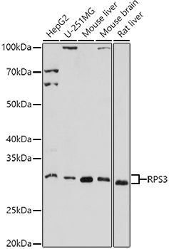 RPS3 Polyclonal Antibody