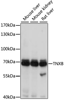 TNXB Polyclonal Antibody