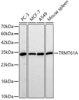 TRMT61A Monoclonal Antibody [2E7K3]