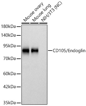 CD105/Endoglin Monoclonal Antibody [1V5J8]