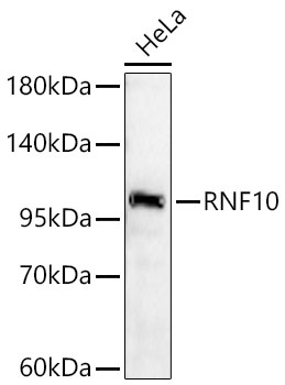 RNF10 Monoclonal Antibody [8E2X2]