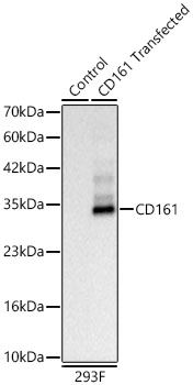 CD161 Monoclonal Antibody [8Q4P5]
