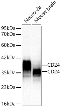 CD24 Monoclonal Antibody [5E7F5]