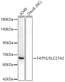 FATP2/SLC27A2 Monoclonal Antibody [8A1Q4]