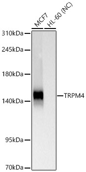 TRPM4 Monoclonal Antibody [5L6V0]
