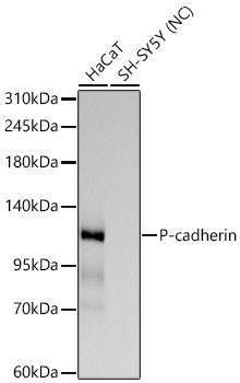 P-cadherin Monoclonal Antibody [10K7V3]