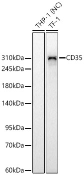 CD35 Monoclonal Antibody [6H9H9]