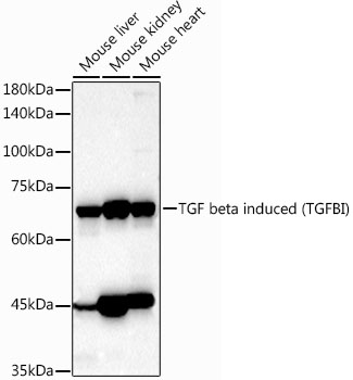 TGF beta induced (TGFBI) Polyclonal Antibody