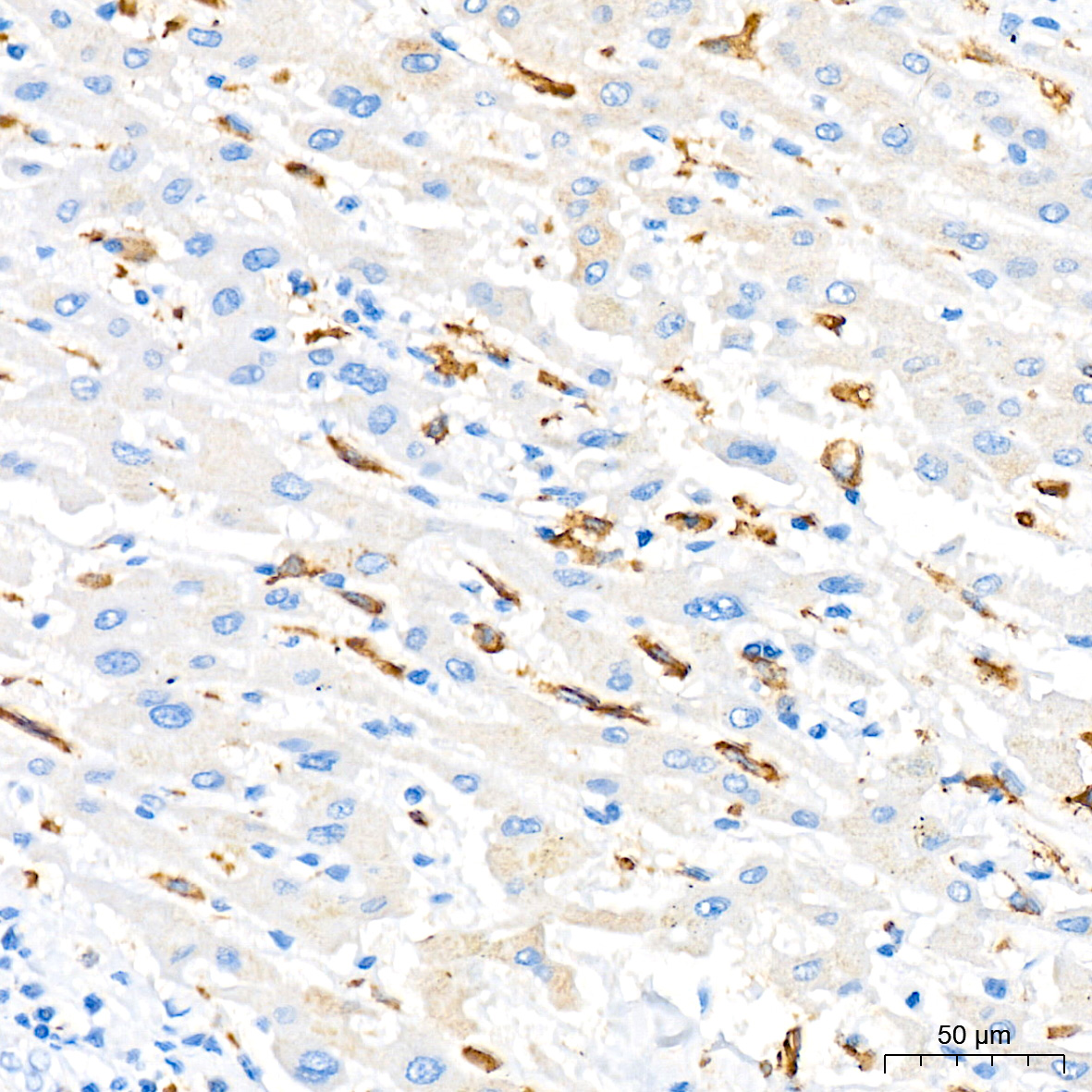 CD204 Monoclonal Antibody