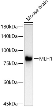 MLH1 Monoclonal Antibody [8K1T2]