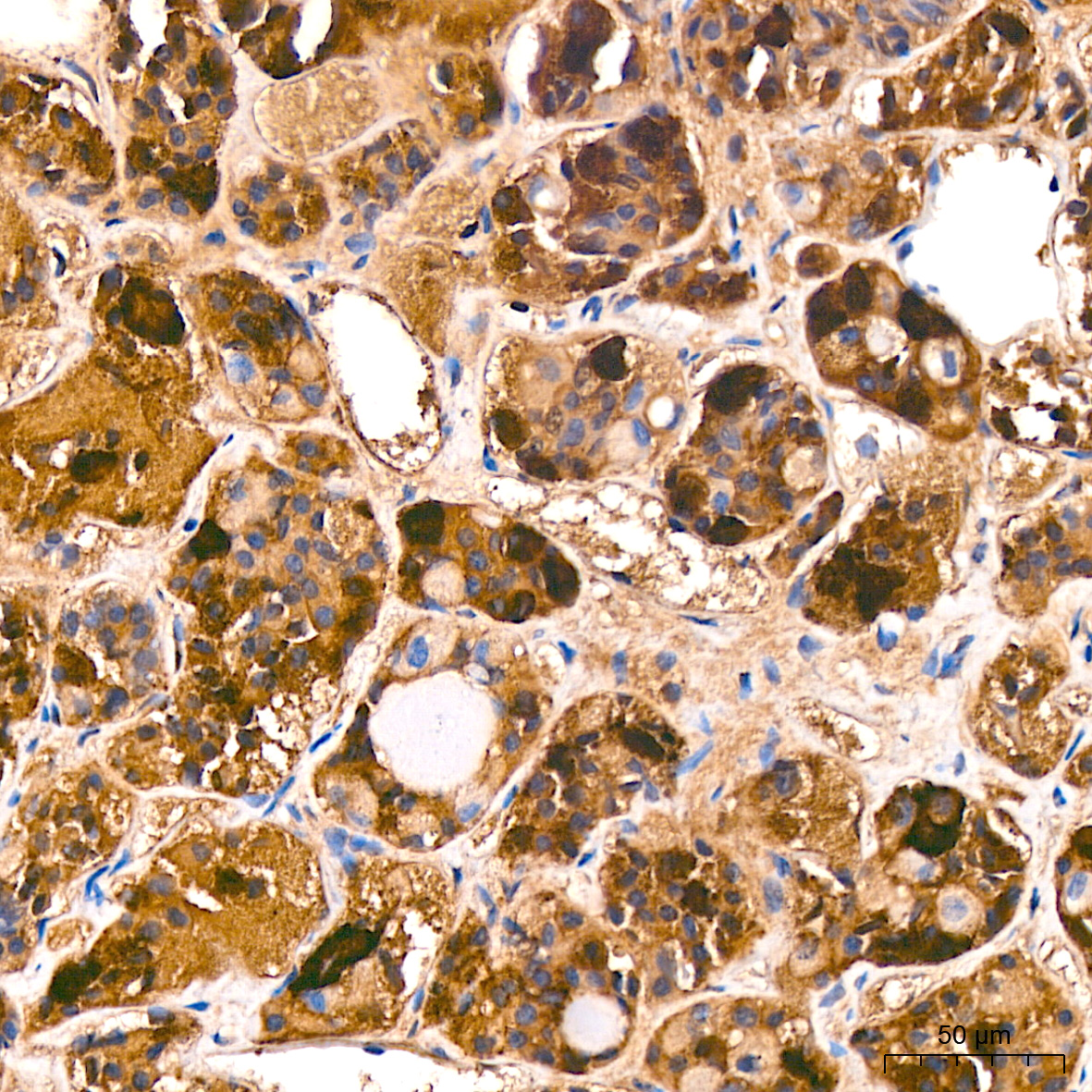 FSH alpha/beta Monoclonal Antibody [7Q5W2]