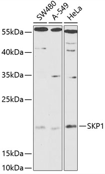SKP1 Polyclonal Antibody