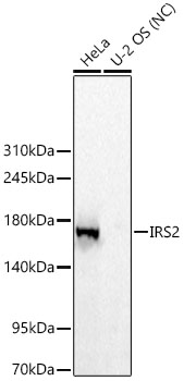 IRS2 Monoclonal Antibody [5R8C0]