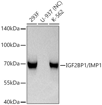 IGF2BP1/IMP1 Monoclonal Antibody [1D7A0]