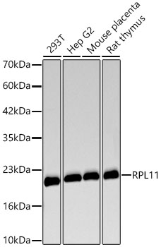 RPL11 Monoclonal Antibody [8G6C1]