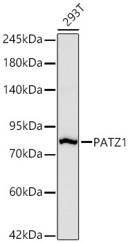 PATZ1 Monoclonal Antibody [6H7A4]