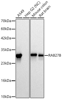 RAB27B Monoclonal Antibody [6J9Q1]