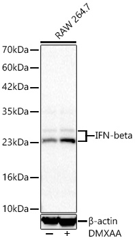 IFN-beta Monoclonal Antibody [6K0L7]