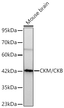 CKM/CKB Monoclonal Antibody [5D1H9]