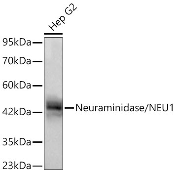 Neuraminidase/NEU1 Monoclonal Antibody [4D3X2]