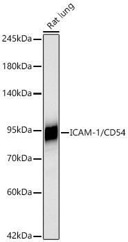 ICAM-1/CD54 Monoclonal Antibody [6Q9H2]