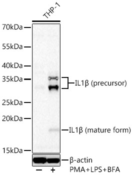 IL1B Monoclonal Antibody [6H10J2]
