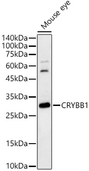 CRYBB1 Polyclonal Antibody